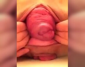 Amateur babe gets her prolapsed cervix examined up close and personal