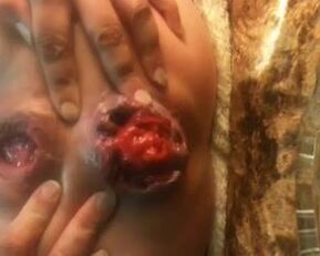 Watch this amateur babe's prolapsed butt on webcam