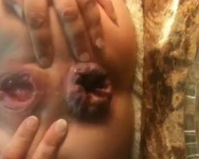 Watch this amateur babe's prolapsed butt on webcam