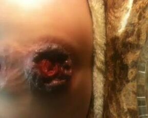 Watch this amateur babe's prolapsed butt on webcam