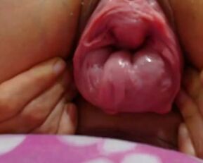 Amateur babe masturbates with cervix dildo in closeup view of her vaginal prolapse