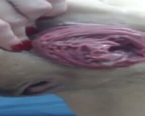 Get ready for a wild ride as Prolapses goes all-in on you