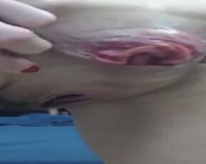 Get ready for a wild ride as Prolapses goes all-in on you