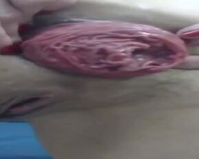 Get ready for a wild ride as Prolapses goes all-in on you