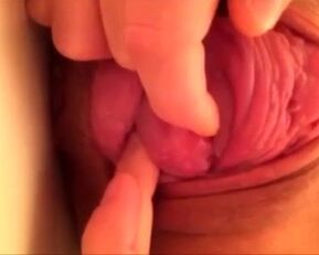 Intense closeup of a cervix prolapse - a hot amateur experience