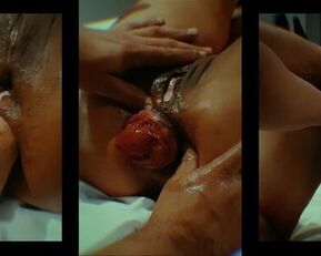 Kinky babe goes extreme with double fisting and prolapse