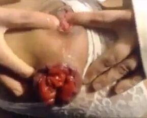 Watch how this amateur gets her prolapsed asshole wrecked with extreme insertions in stockings & panties