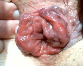 Watch Olibrius71's massive prolapses and golden showers