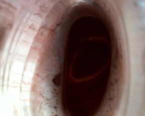 Watch Olibrius71's massive prolapses and golden showers