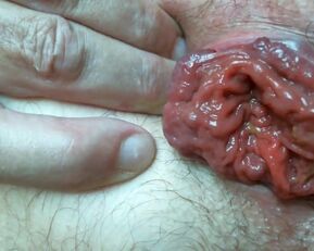 Watch this sissy humiliate herself with prolapse and swallow