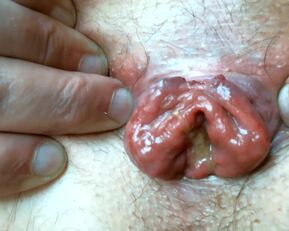 OLibrius71 indulges in extreme piss drinking and prolapse fun