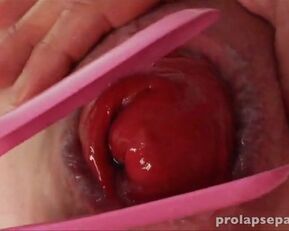 Pink-haired babe gets her ass stretched by dildo and prolapse speculum