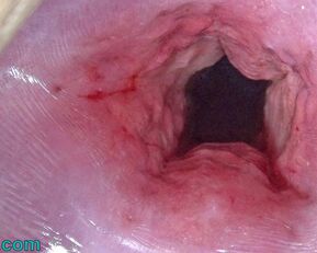 Asian MILF Cervix Stretches & Dilation Uterus with Penetration