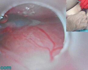 Kinky Japanese MILF Inseminates and Creampies Uterus Cam