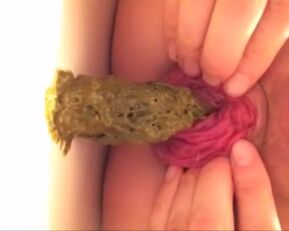 Watch this amateur MILF's prolapsed anal hole get a closeup view