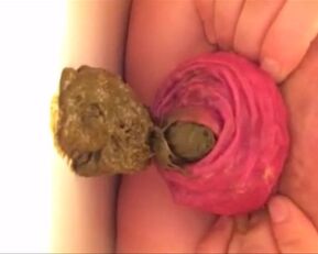 Watch this amateur MILF's prolapsed anal hole get a closeup view