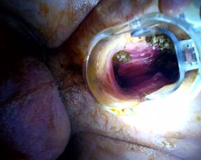 Voyons Deduces: Prolapse Pisses & Wants a Wet Pounding