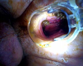 Voyons Deduces: Prolapse Pisses & Wants a Wet Pounding