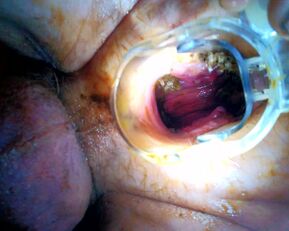 Voyons Deduces: Prolapse Pisses & Wants a Wet Pounding