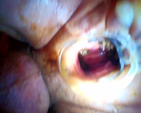 Voyons Deduces: Prolapse Pisses & Wants a Wet Pounding