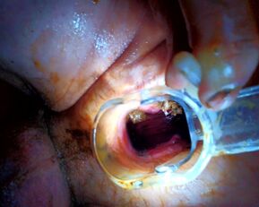 Voyons Deduces: Prolapse Pisses & Wants a Wet Pounding