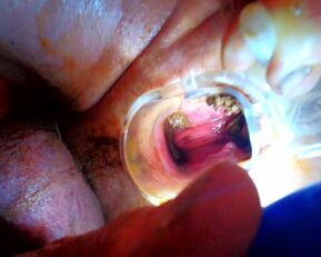 Voyons Deduces: Prolapse Pisses & Wants a Wet Pounding