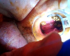 Voyons Deduces: Prolapse Pisses & Wants a Wet Pounding