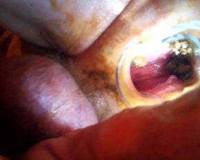 Voyons Deduces: Prolapse Pisses & Wants a Wet Pounding