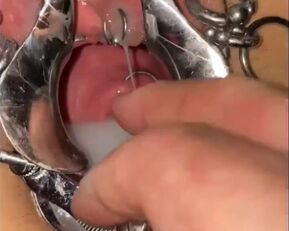 Get a sneak peek of your cervix being opened up and sounding