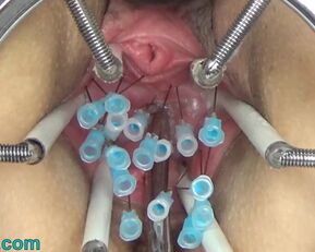 Watch German BDSM Mistress Needles inner Pussy Cervix & Tits pumped hard in extreme BDSM session