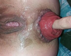 Get ready for a wild ride as this babe stretches her pussy with a prolapse