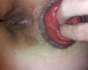 Get ready for a wild ride as this babe stretches her pussy with a prolapse