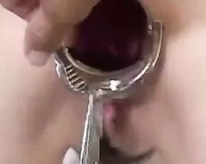 Get ready for a wild Asian anal ride in "Asian Anal Stretching 2"