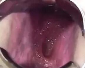 Get ready for a wild Asian anal ride in "Asian Anal Stretching 2"