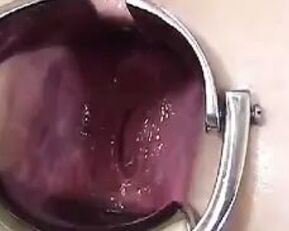 Get ready for a wild Asian anal ride in "Asian Anal Stretching 2"