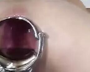 Get ready for a wild Asian anal ride in "Asian Anal Stretching 2"