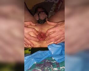 french slut scat anal dilation and prolapse